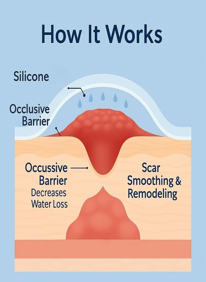 PUREEASE Silicone Scar Sheets – Reusable Medical-Grade Silicone Gel Strips for Body & Face – Soft, Invisible & Flexible – 1.4 x 4.3 in – 6 Clear Patches for Old & New Scars – Smoother Skin Appearance - Image 5